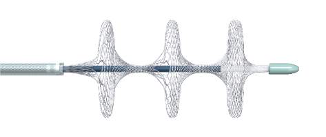 國內首創！本市研發生產的1款Ⅲ類創新醫療器械獲批上市，為具有溶栓禁忌癥的患者提供了治療選擇